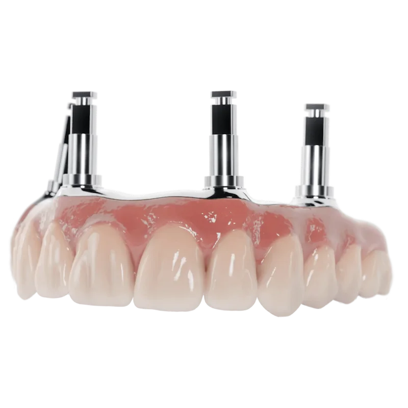 Full-Arch Solutions imge